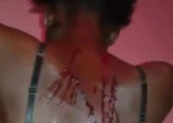 Les femmes juristes héritent de l’affaire Ndeye Codou battue sauvagement par son époux