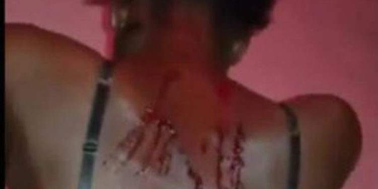 Les femmes juristes héritent de l’affaire Ndeye Codou battue sauvagement par son époux