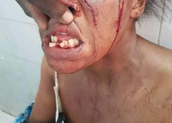 Une Aawo lacère sa co-épouse à …