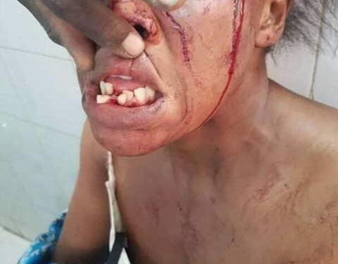 Une Aawo lacère sa co-épouse à …