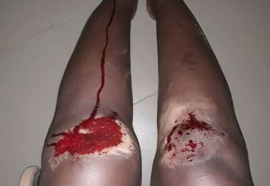 Tambacounda : Attention aux bandits, une enseignante victime d’un vol à l’arrachée est grièvement blessée