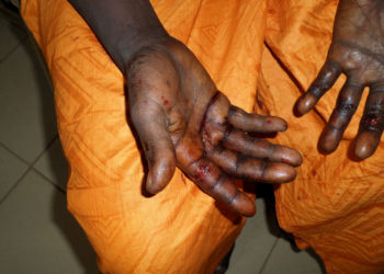 Violences faites aux femmes à Tambacounda: Drogue, alcool, jalousie … les racines du mal.