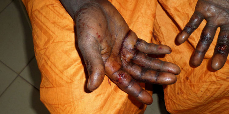 Violences faites aux femmes à Tambacounda: Drogue, alcool, jalousie … les racines du mal.