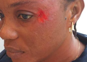 Agression de Coumba Ngom Ndiaye : les profs suspendent les cours et annoncent une plainte contre l’élève