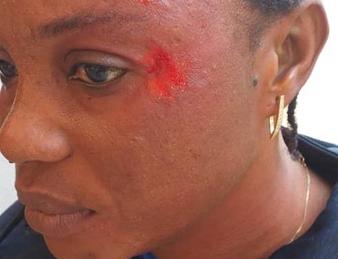 Agression de Coumba Ngom Ndiaye : les profs suspendent les cours et annoncent une plainte contre l’élève