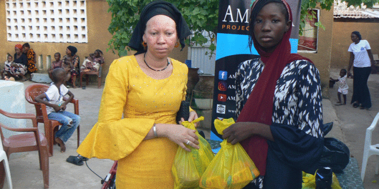 Tamba : Amana Projects en collaboration avec MAOJA, offre des kits et matériels aux personnes vivant avec un handicap