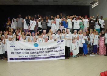 Tambacouda: sensibilisation sur les violences faites aux femmes et filles atteintes d’albinisme