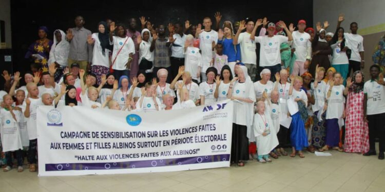Tambacouda: sensibilisation sur les violences faites aux femmes et filles atteintes d’albinisme