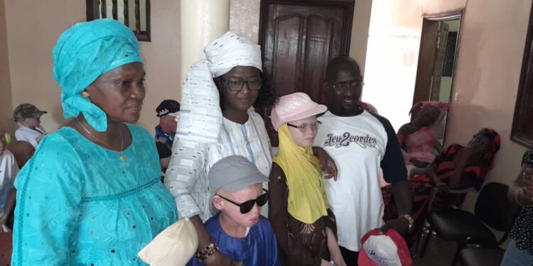 Tambacounda : Le partenariat entre « Priorité Enfance », « Sous le Parasol » et « les petites gouttes » a permis de remettre plusieurs produits et équipements de protection aux albinos